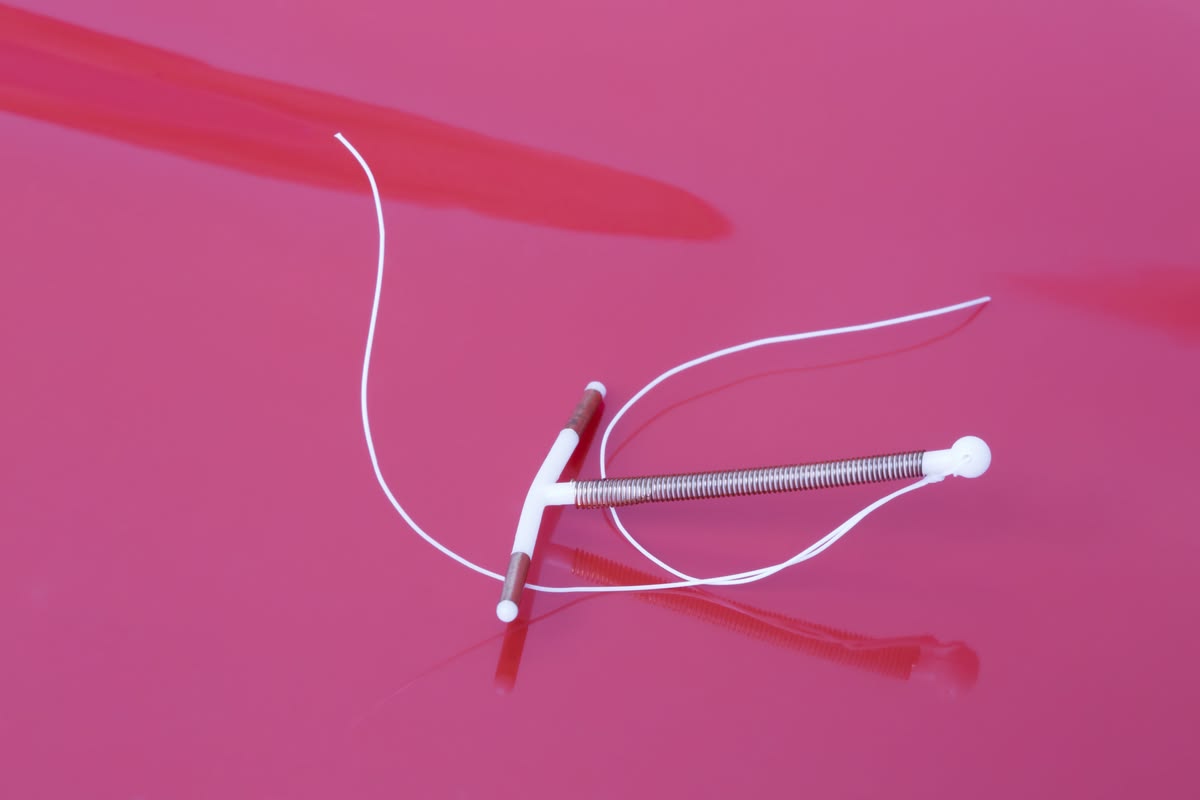 Hysteroscopic Copper-T removal