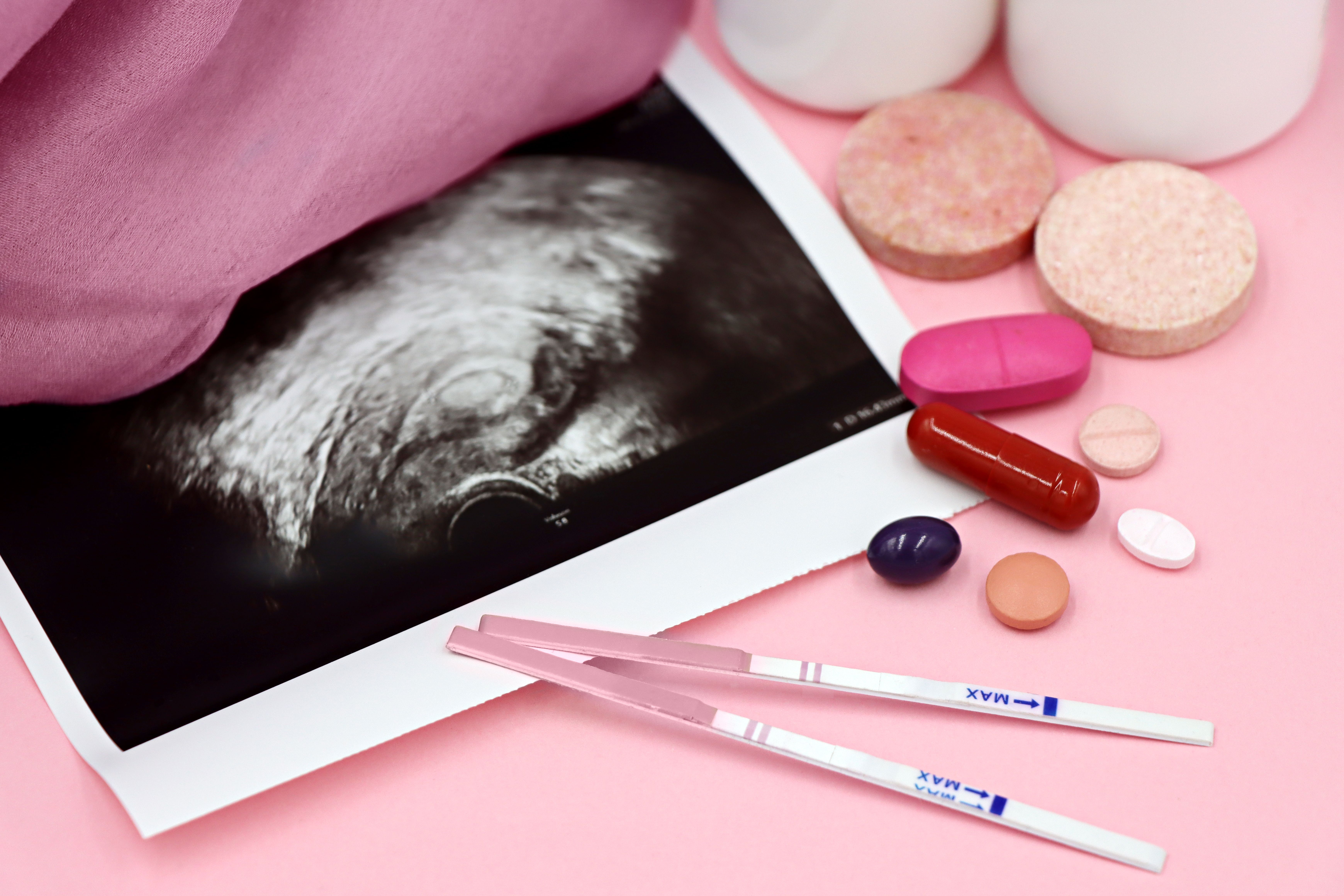 Diagnosis and treatment of ectopic pregnancy