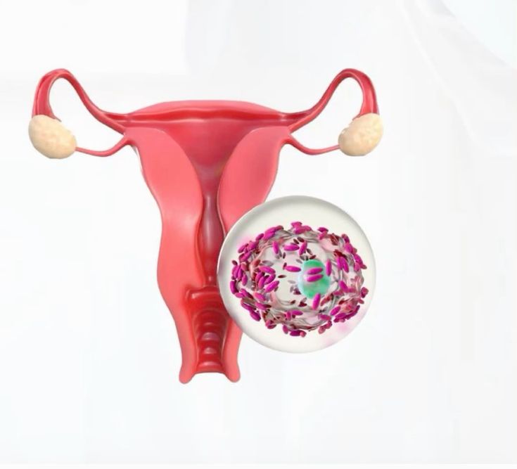 Endometrial biopsy consultation