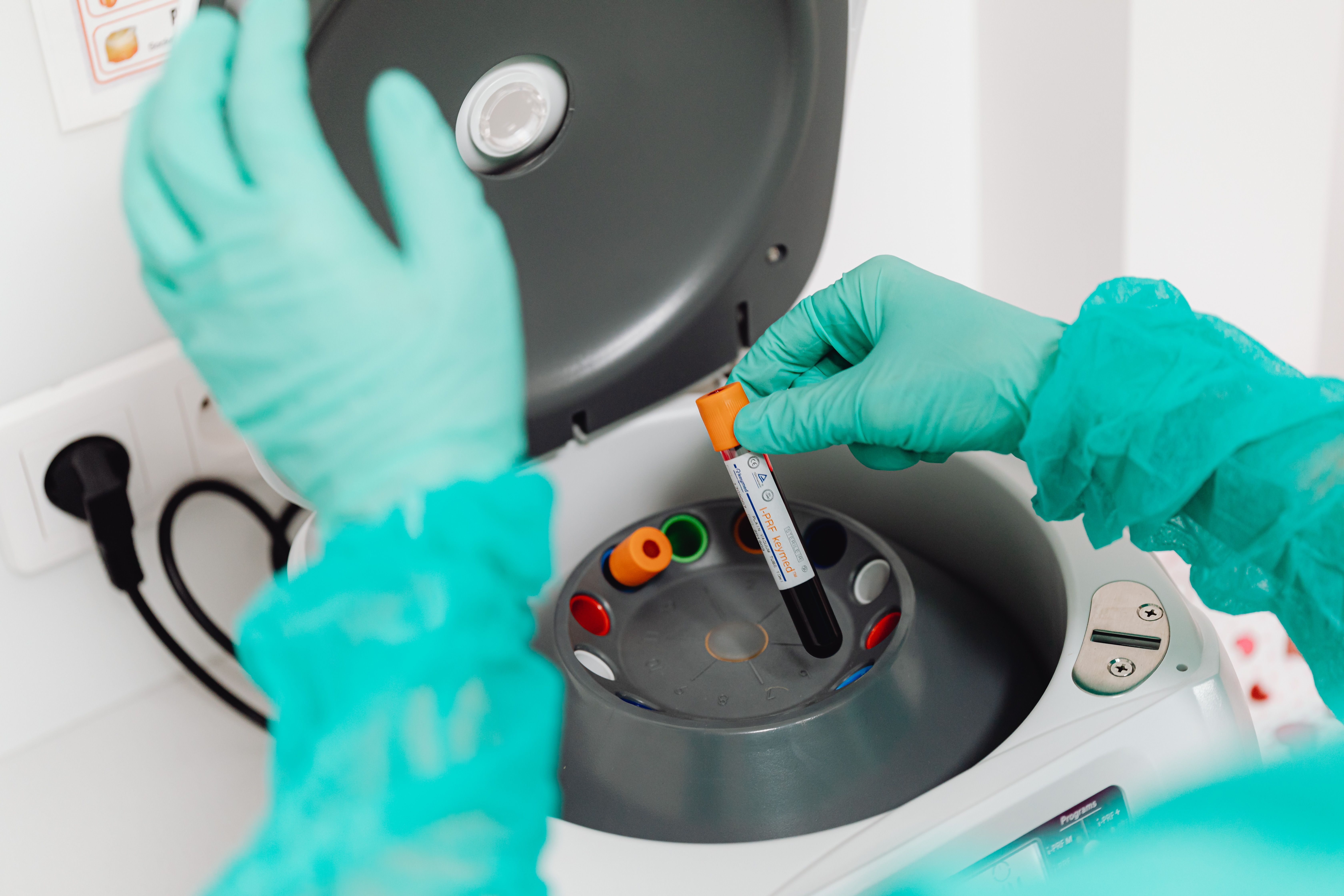 IVF-ICSI treatment consultation