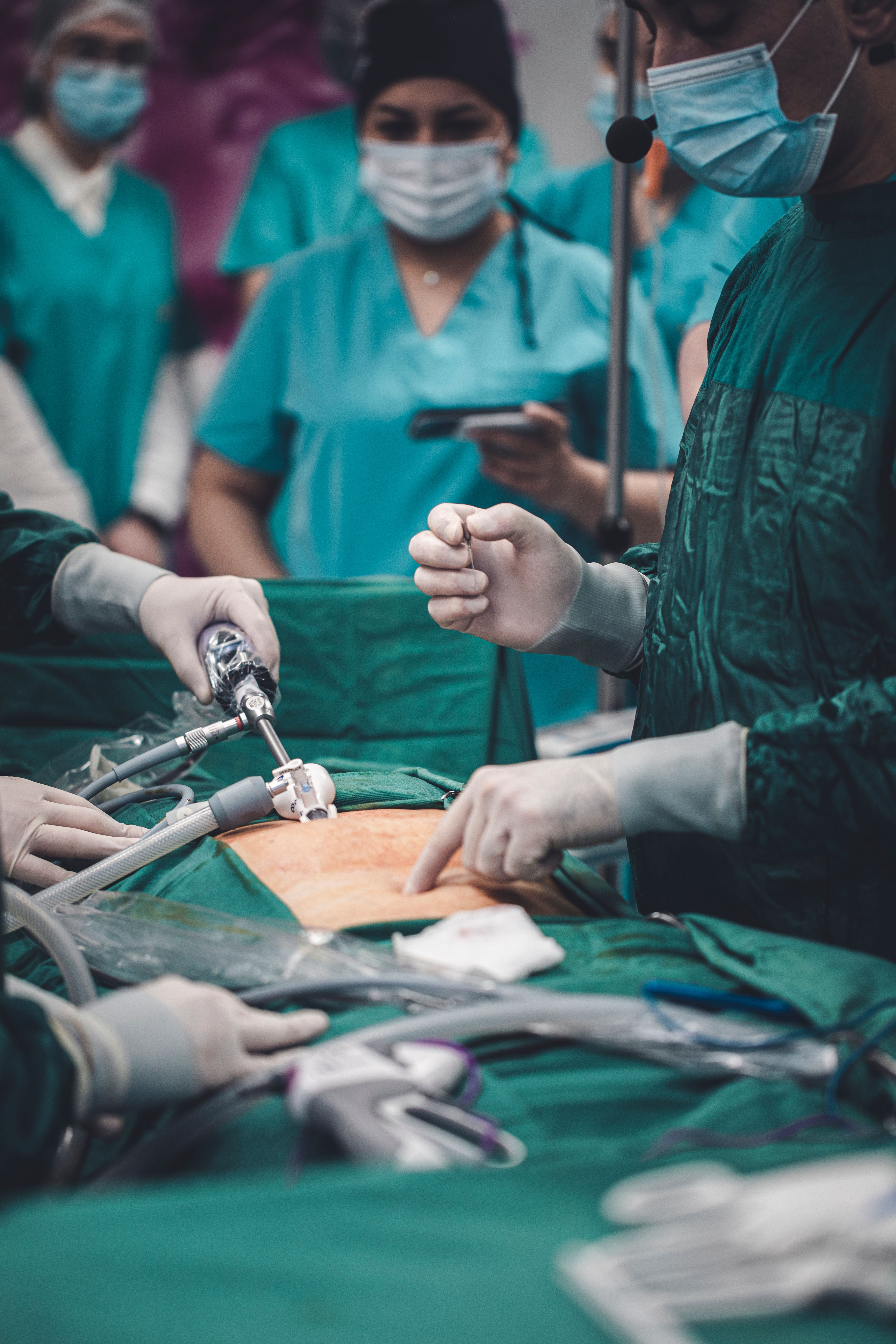 Laparoscopic fibroid removal consultation