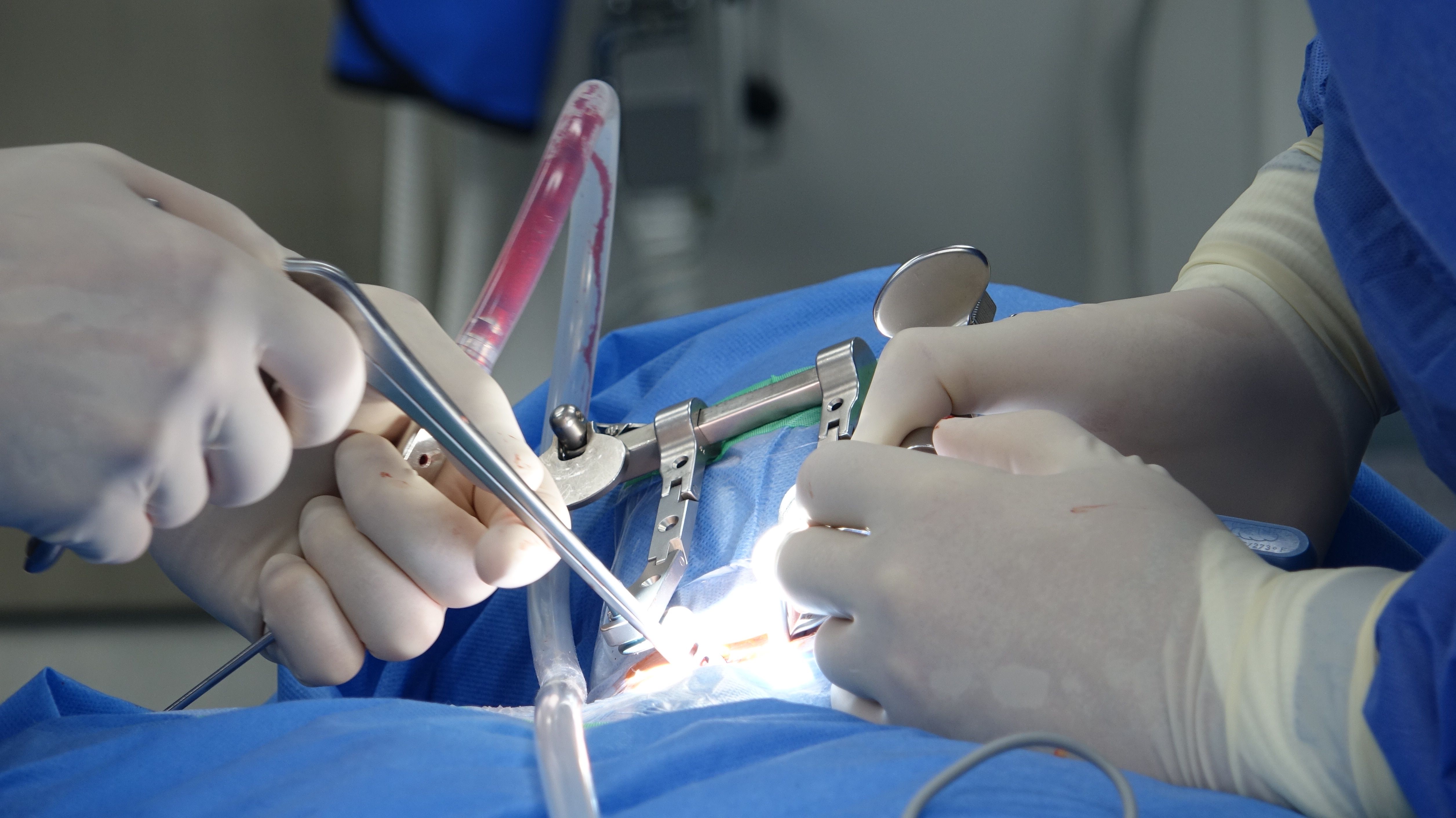Painless delivery with epidural care