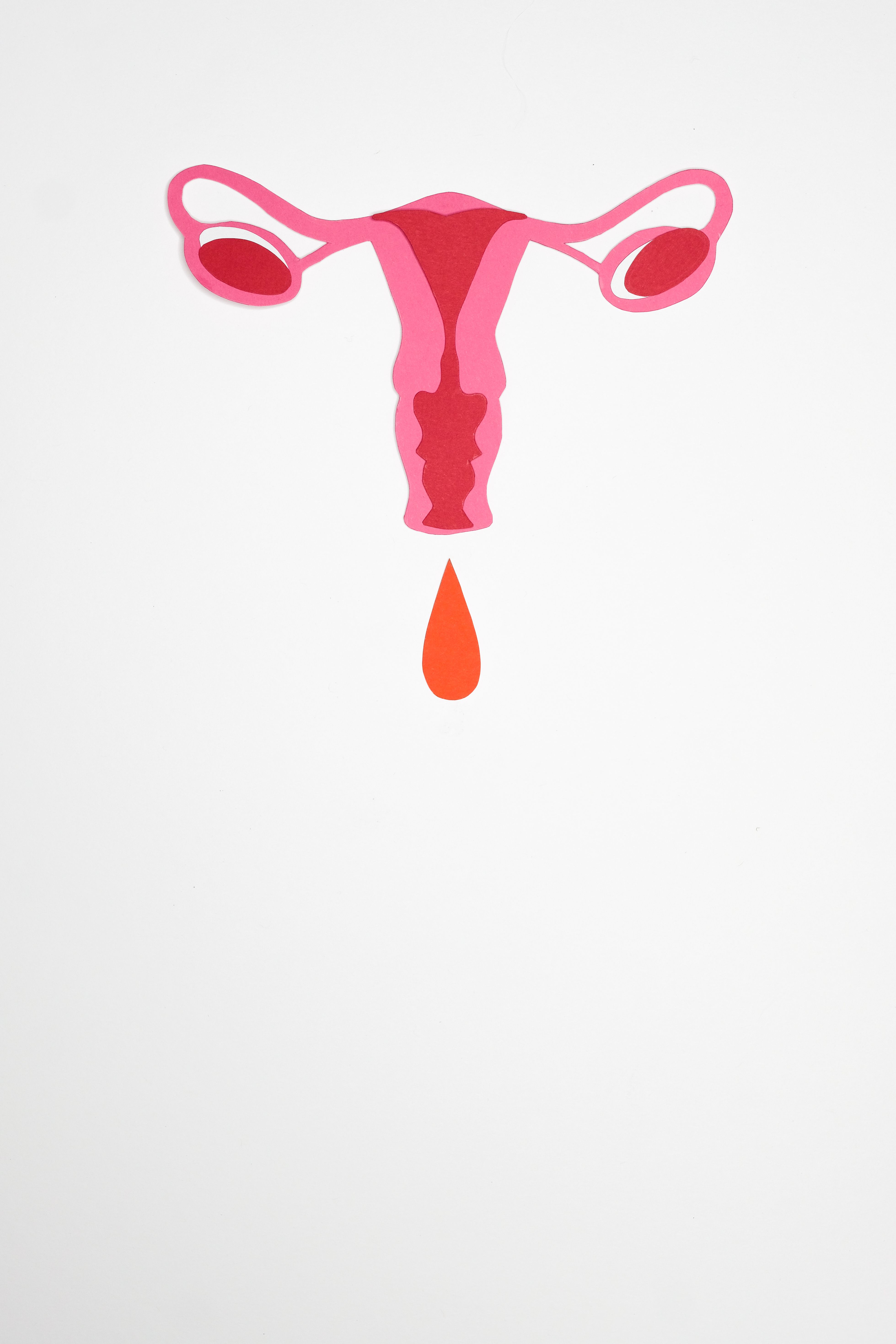 Hysteroscopic uterine septum surgery